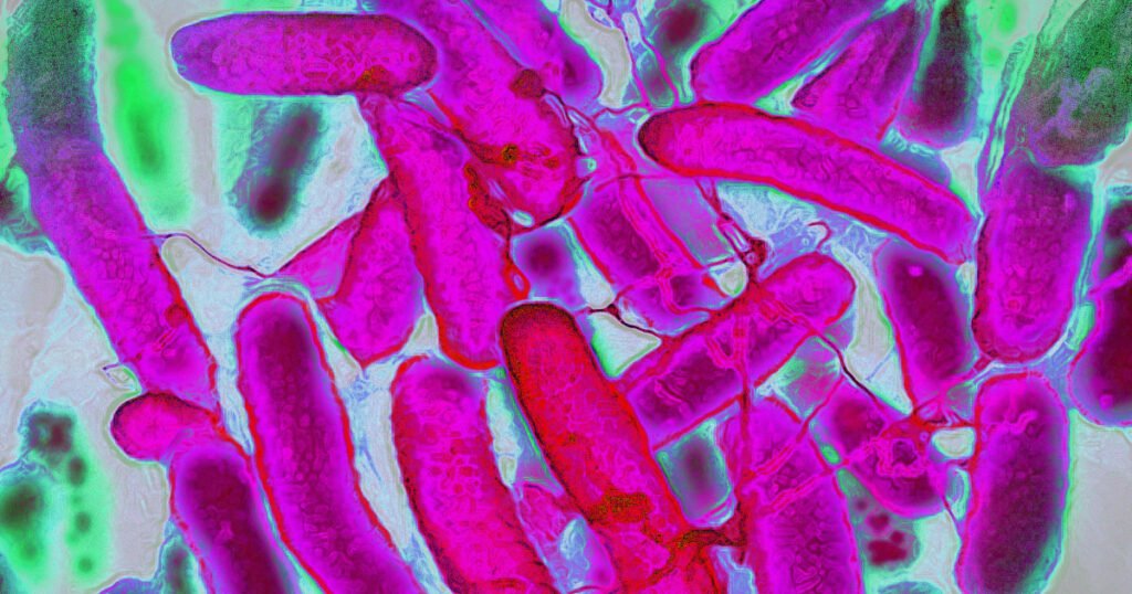 Rise in colon cancer among young people may be tied to gut toxin known to cause DNA damage