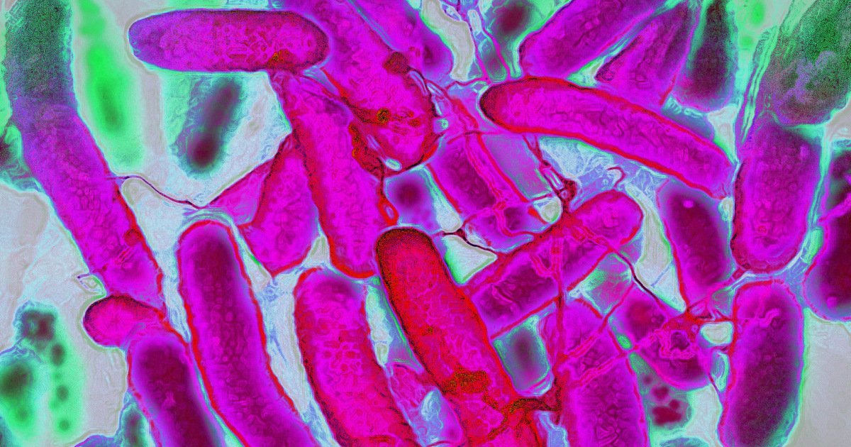 Rise in colon cancer among young people may be tied to gut toxin known to cause DNA damage