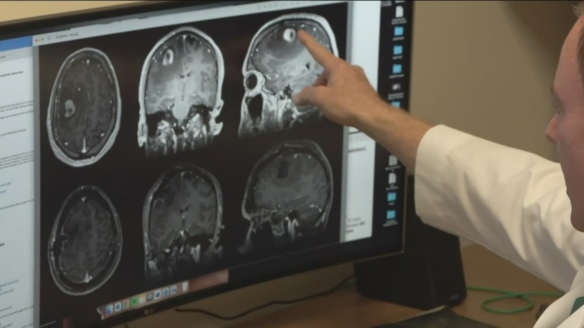 COVID ages brains by 6 months, study shows