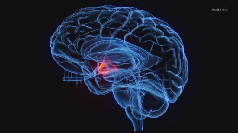 Why some antidepressant medication can cause more sweating: HealthLink