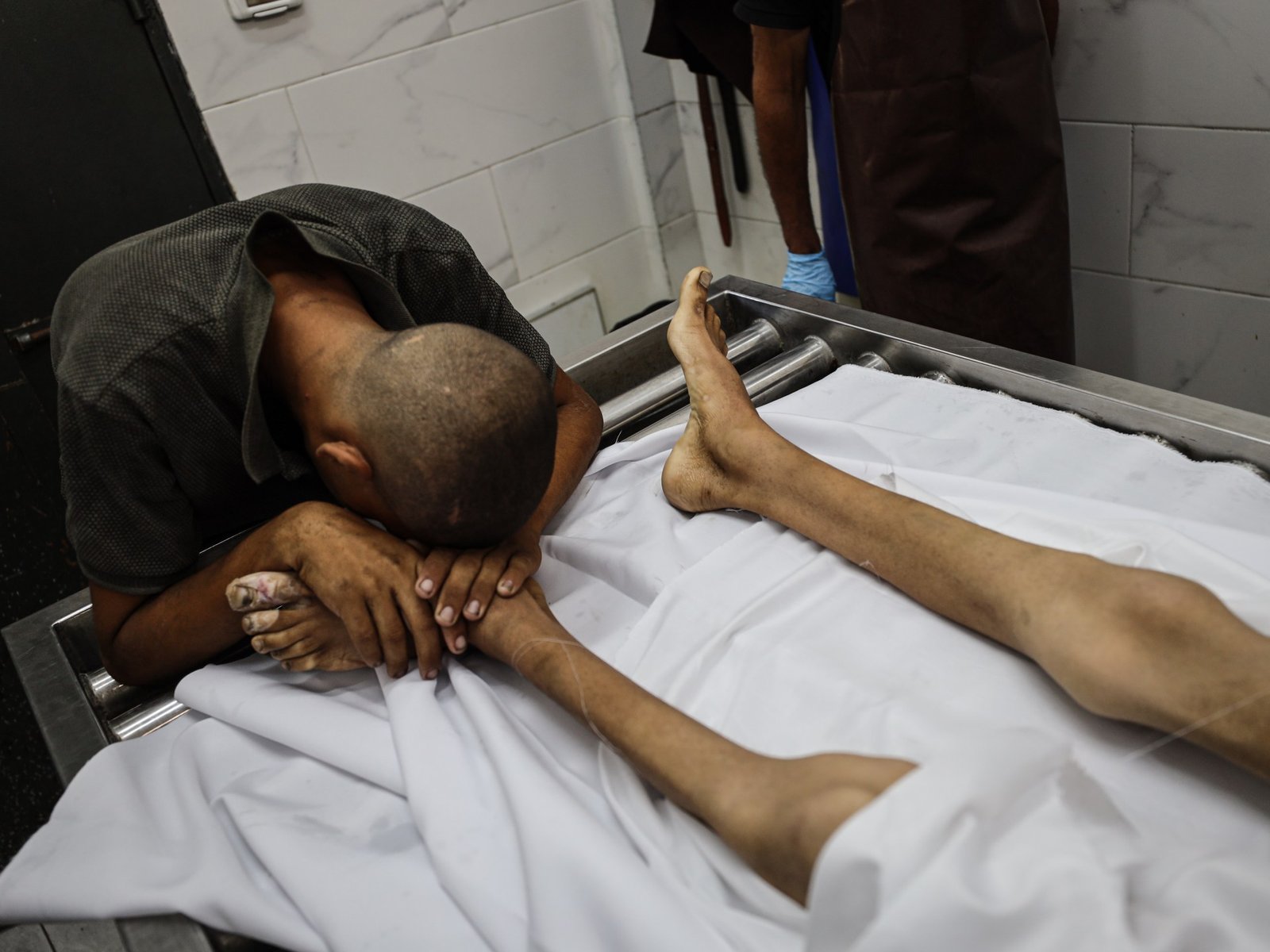 Palestinian boy, 17, dies of Israel-induced starvation in Gaza | Israel-Palestine conflict News
