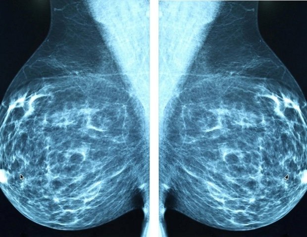 Researchers identify molecular mechanism behind tamoxifen-related uterine cancer https://internetconnectz.com/trendy-health-connectz/page/5/