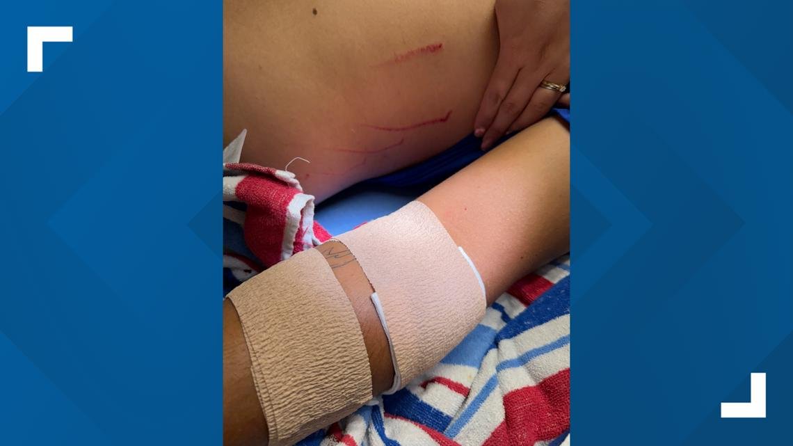 VIDEO: Florida man survives bear attack at home