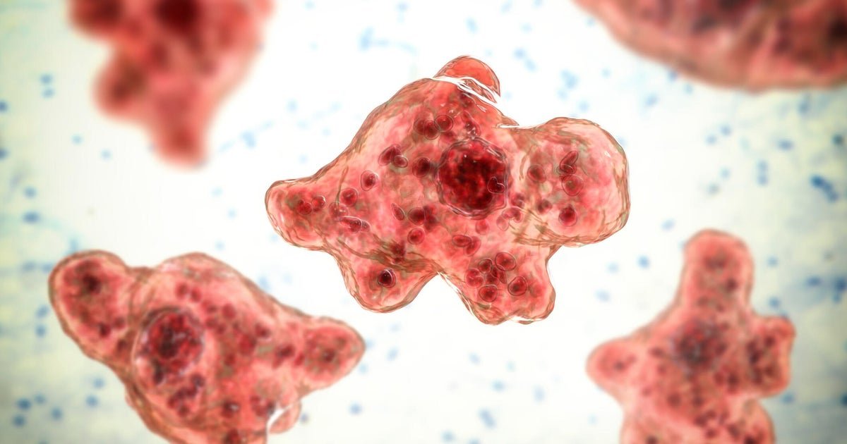 Rare brain-eating amoeba infection possibly linked to water skiing confirmed in Missouri