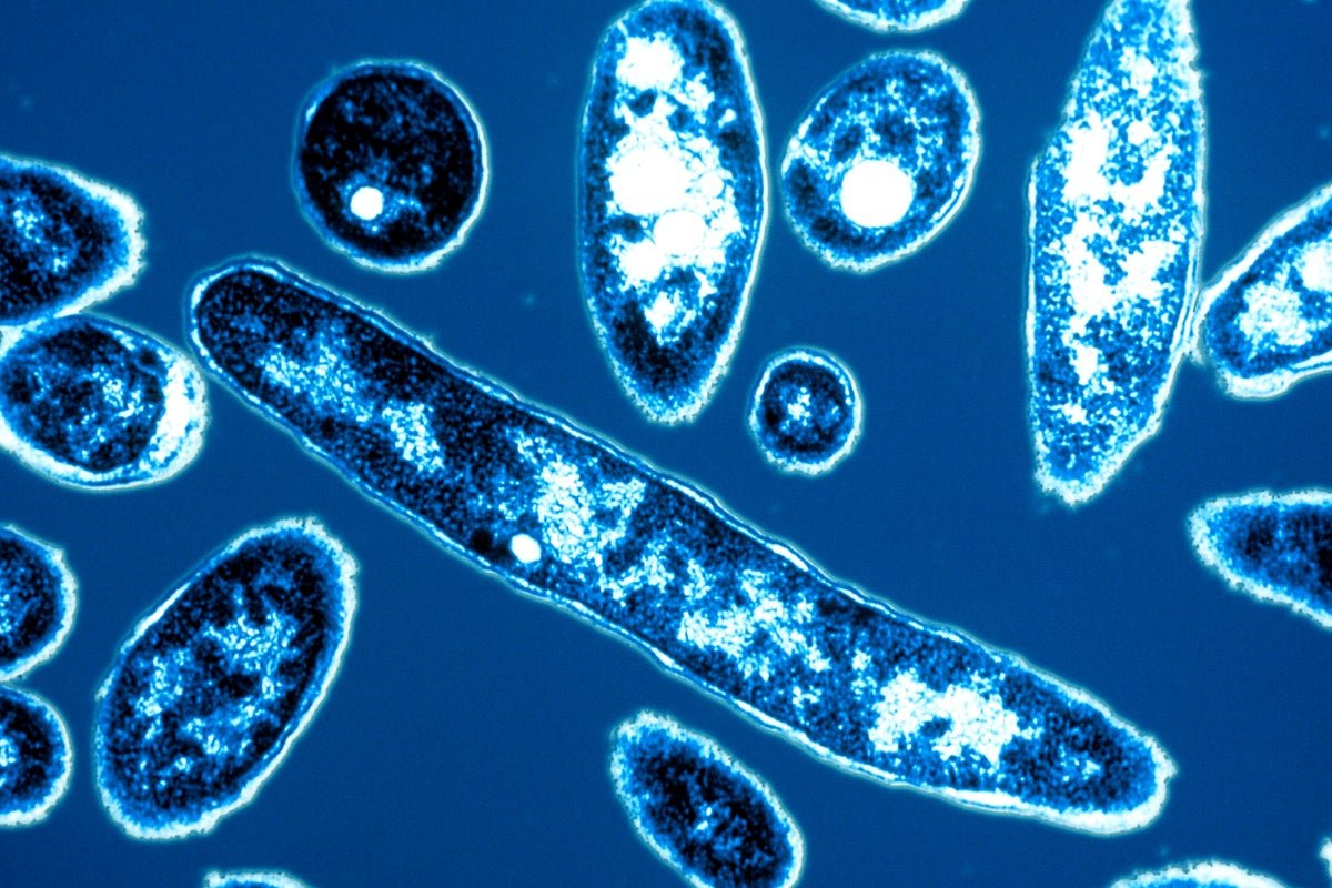 legionella_pheumophia_legionnaires_disease_under_microscope.jpg Legionnaires’ Disease Outbreak in New York City Linked to Cooling Towers