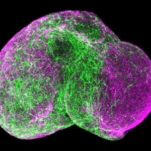 Tiny Lab-Grown ‘Brains’ Raise Big Ethical Questions