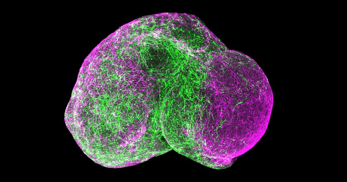 Tiny Lab-Grown 'Brains' Raise Big Ethical Questions https://internetconnectz.com/trendy-health-connectz/page/5/