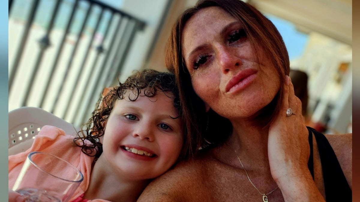 Florida flesh-eating bacteria survivor recounts harrowing battle