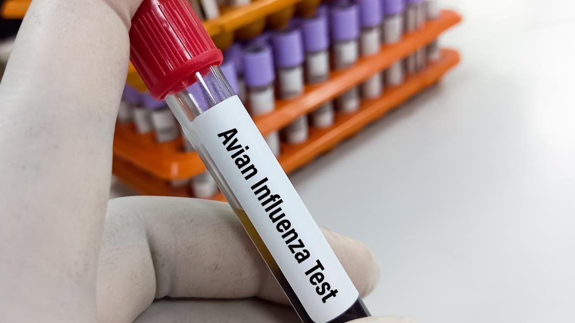 Bird flu in Henry County backyard flock | What to know https://internetconnectz.com/trendy-health-connectz/