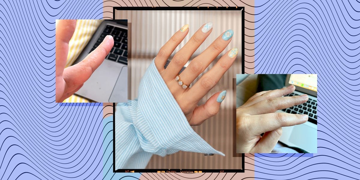 The truth about HEMA in gel nail polish – "How I developed the painful allergy" https://internetconnectz.com/diy-connectz/