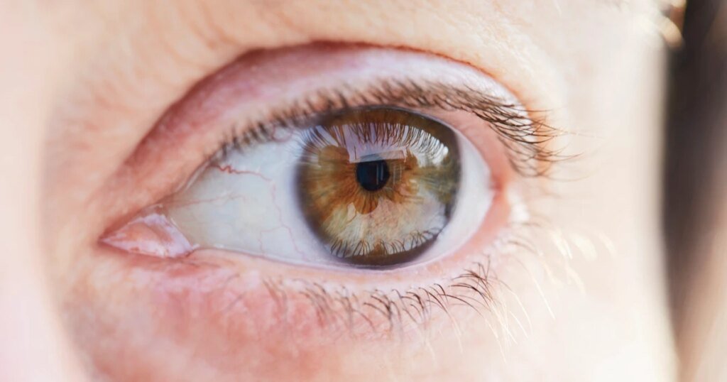 251017 eye stock aa 427 b14105.jpg