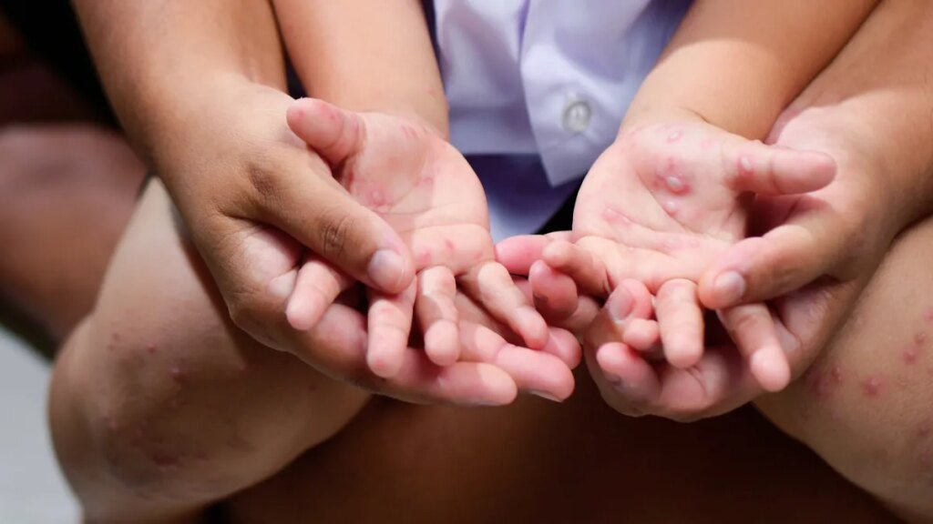 Gettyimages 2240770311.jpg