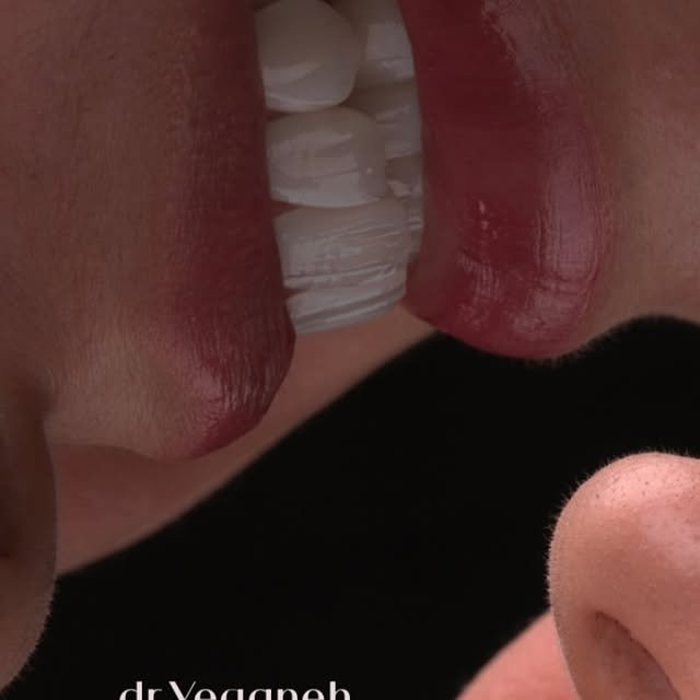 Your smile, our passion. We use the latest in bio-technology to create a ceramic concoction …