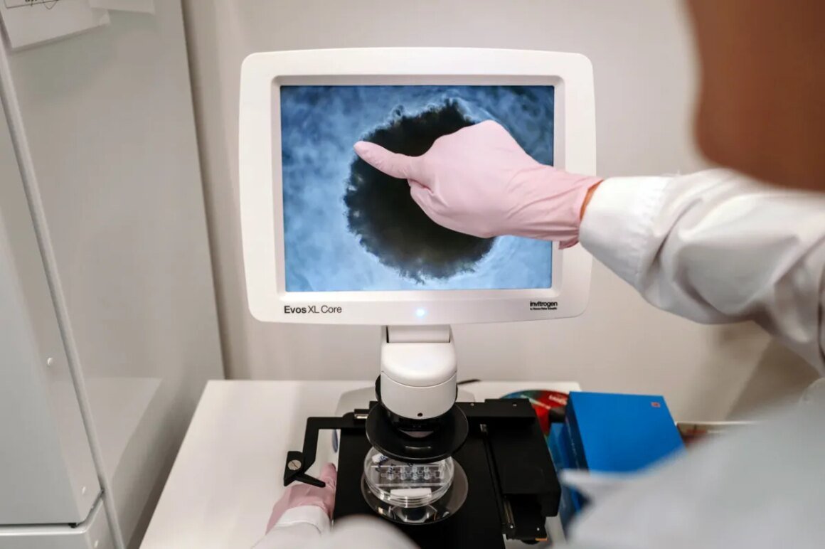Colorectal Cancer: Facts You Should Know