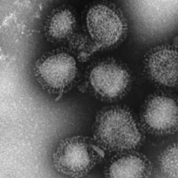 Doctors warn of surging flu cases as 1,900 Americans have died, including children