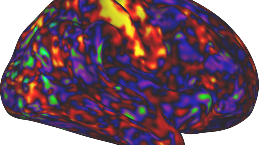 urlhttp3A2F2Fnpr-brightspot.s3.amazonaws.com2Fd62Fdb2F4885a67e498cb9ee3415fdd7f98e2Fbrain-s.png ADHD drugs may boost arousal more than attention : Shots