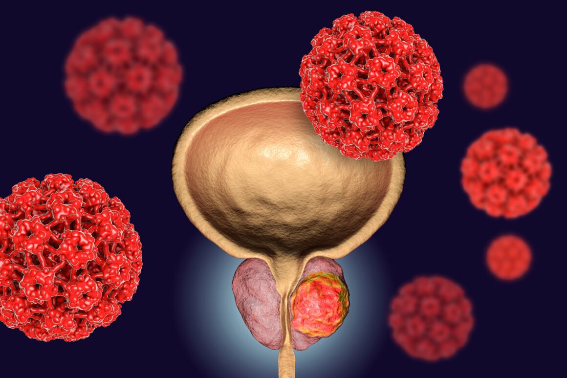 Can Color Vision Deficiency Impact Survival in Bladder or Colorectal Cancer