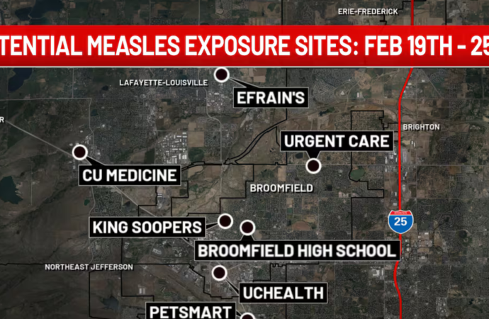 Colorado health officials warn of measles exposure at locations in several Denver-area cities
