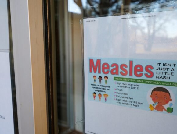 Measles_71091-scaled.jpg Potential measles exposure reported in downtown Bethesda