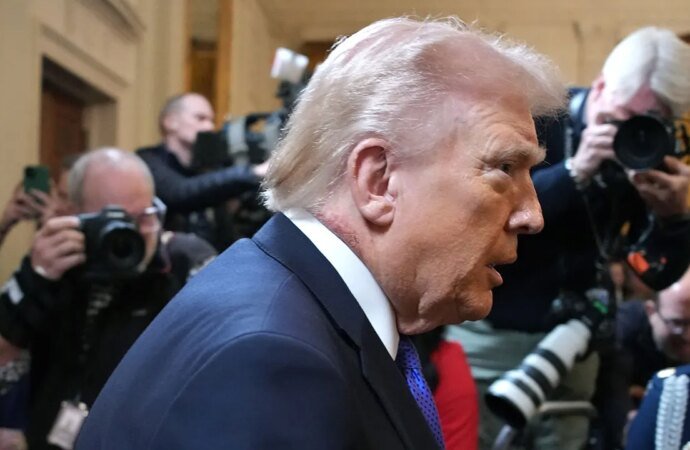 White House doctor explains President Trump’s neck rash at Medal of Honor event