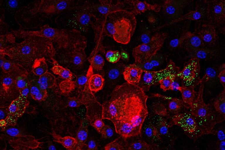 Aging Immune Cells Linked to Fatty Liver Disease 