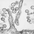 More details emerge on hantavirus patients on cruise ship
