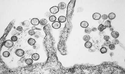 Sin Nombre hanta virus TEM PHIL 1136 lores.jpg