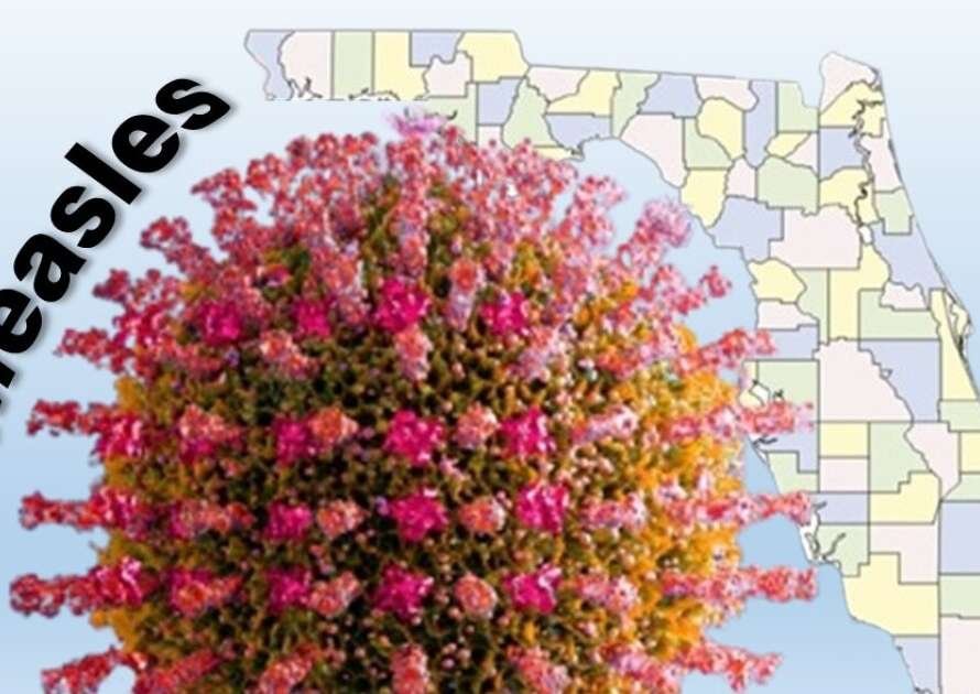 Florida goes a week without a new measles case, according