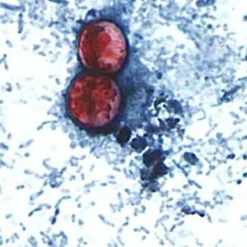 Diarrhea-causing parasite that can contaminate raw produce causing misery across several states
