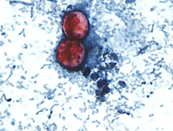 Diarrhea-causing parasite that can contaminate raw produce causing misery across several states