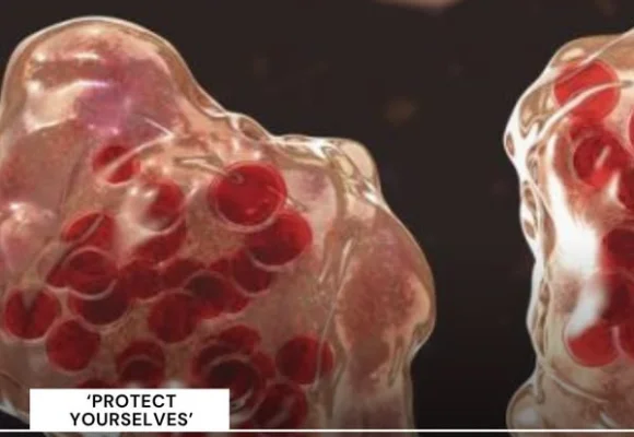 Fox 8 News – Patients in the outbreak were all…