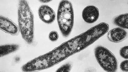 Legionnaires disease AP 25217487211936.jpeg