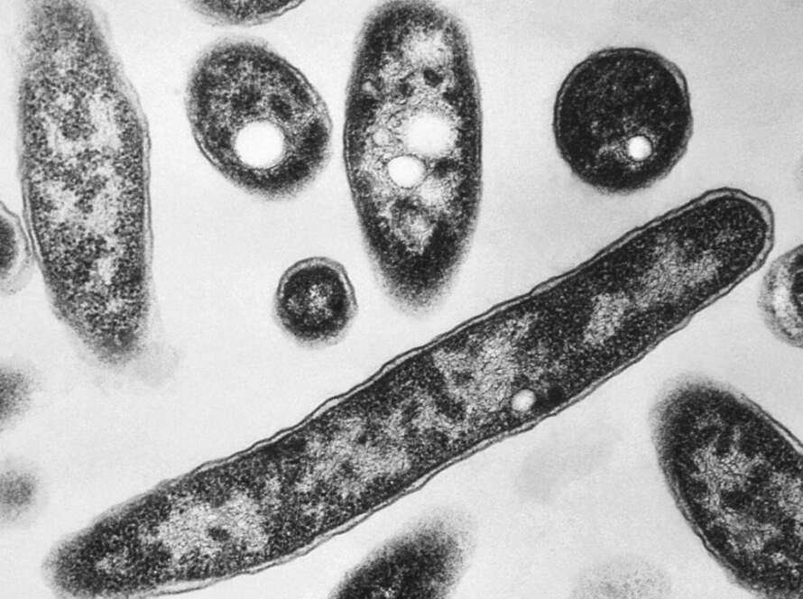 Legionnaires disease AP 25217487211936.jpeg