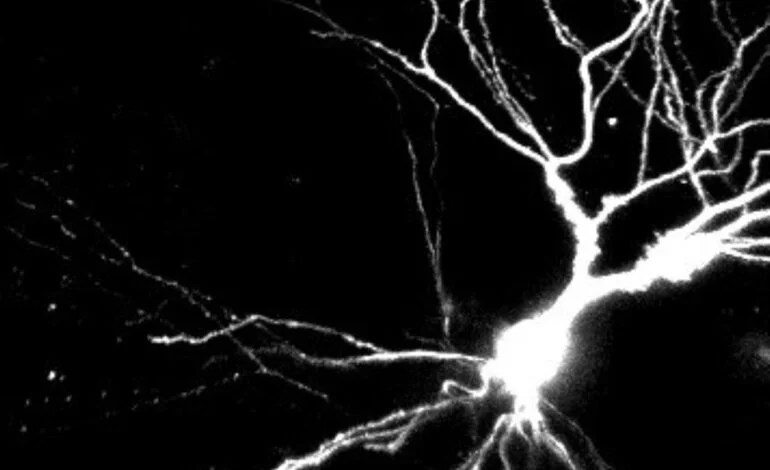 Dendrites may be key to learning and memory, study suggests: Newsroom