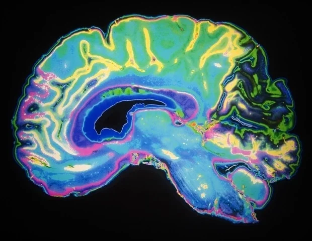 Artificially Colored MRI Scan Of Human Brain Daisy Daisy a8c5d8bbbf824bc8932308e30187510f 620x480.jp .webp